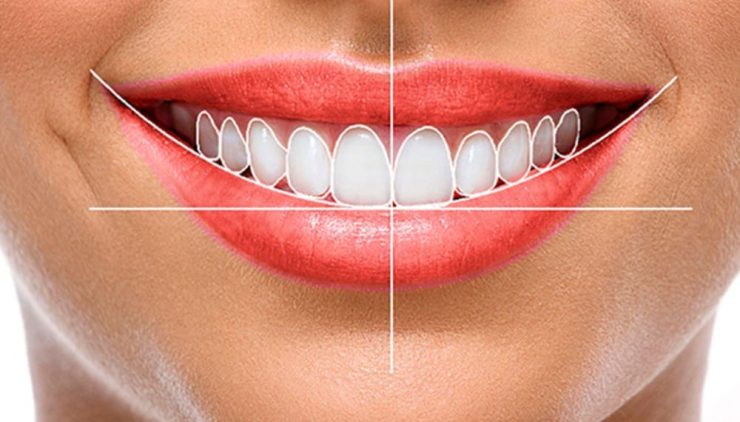 Estética Dental